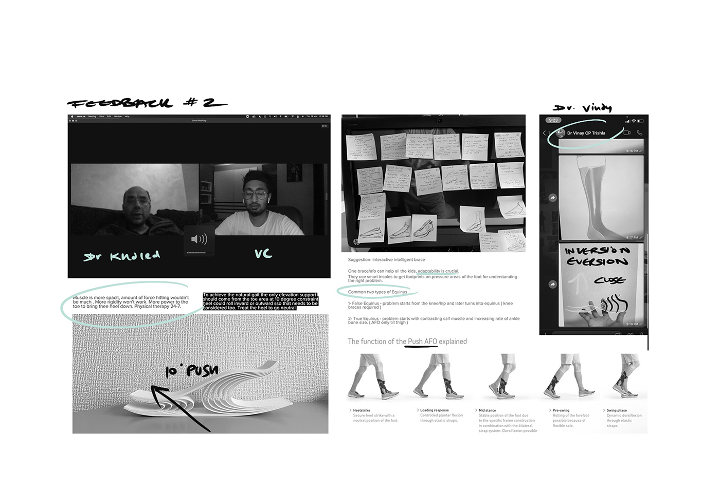 medical care，Science and Technology，product design，bionics，Prosthesis，