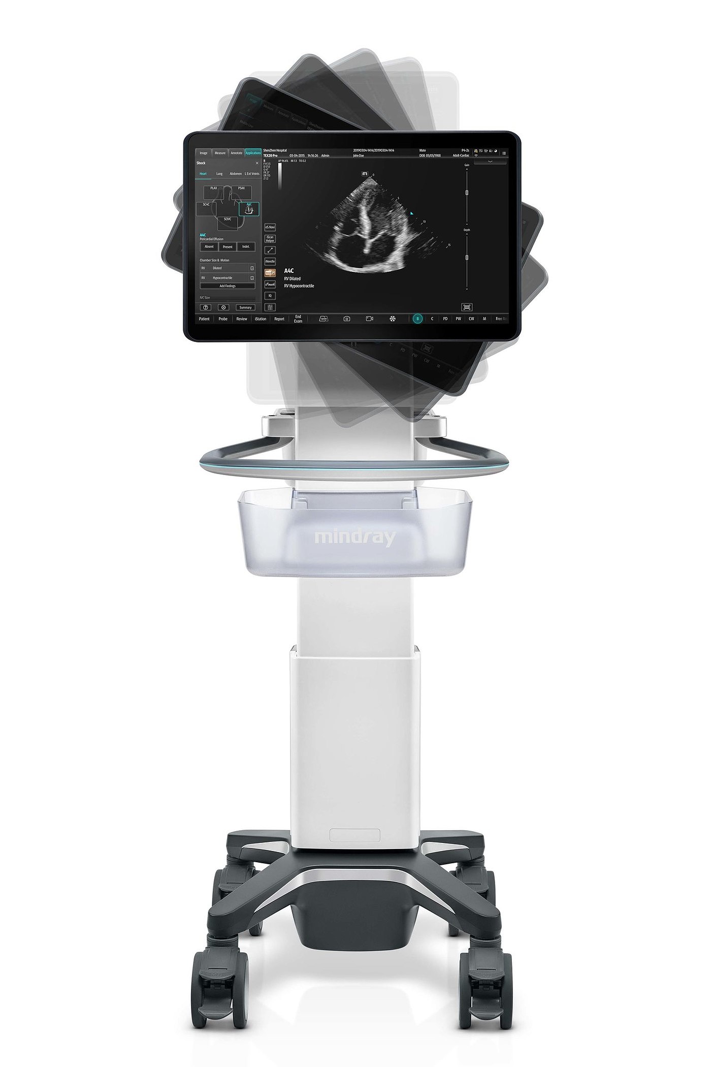 product design，Medicine/Health，Ultrasonic diagnosis system，