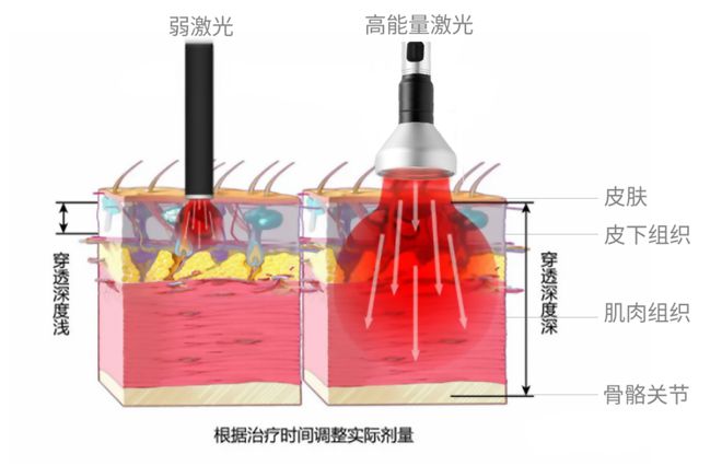 Laser therapy，Animal therapeutic instrument，cosmetic instrument，medical apparatus and instruments，Appearance design，industrial design，Structural design，