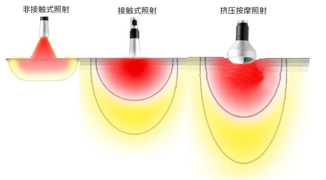 Laser therapy，Animal therapeutic instrument，cosmetic instrument，medical apparatus and instruments，Appearance design，industrial design，Structural design，
