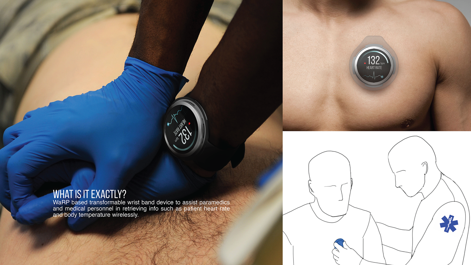 work efficiency，Medical staff，custody，WaRP Smartwatch，
