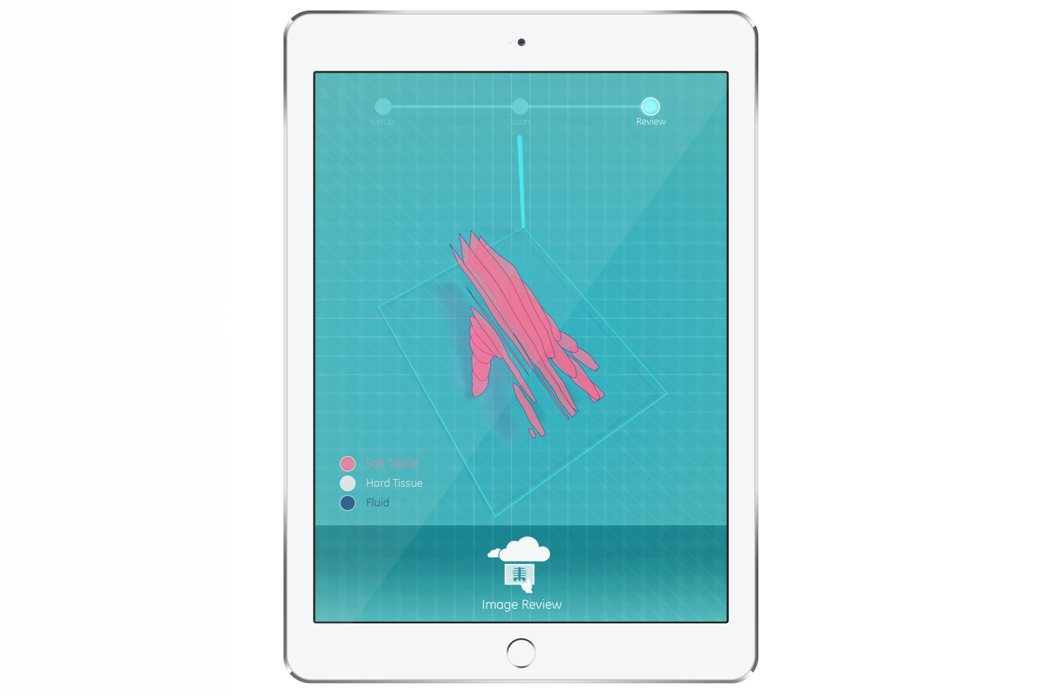 Philip Stanka，FOR IMAGING ON，Medical equipment，move，