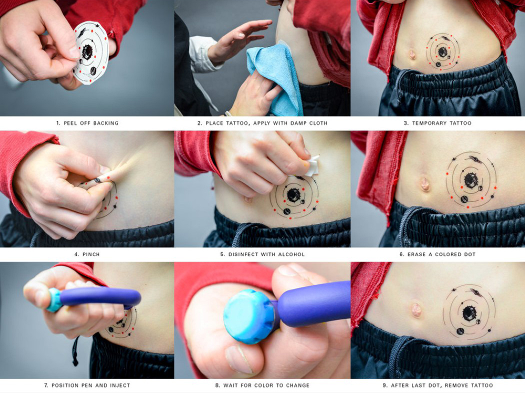 medical care，Children's fun design，Tool box，Insulin injection，