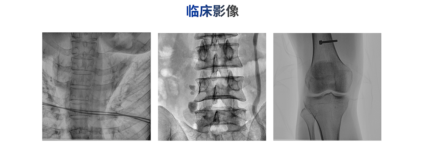 C- arm，X-ray machine，