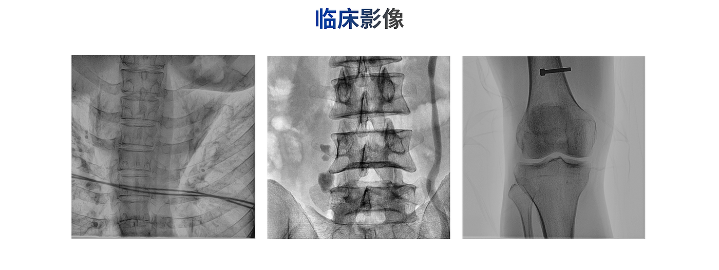 C型臂，X射线机，