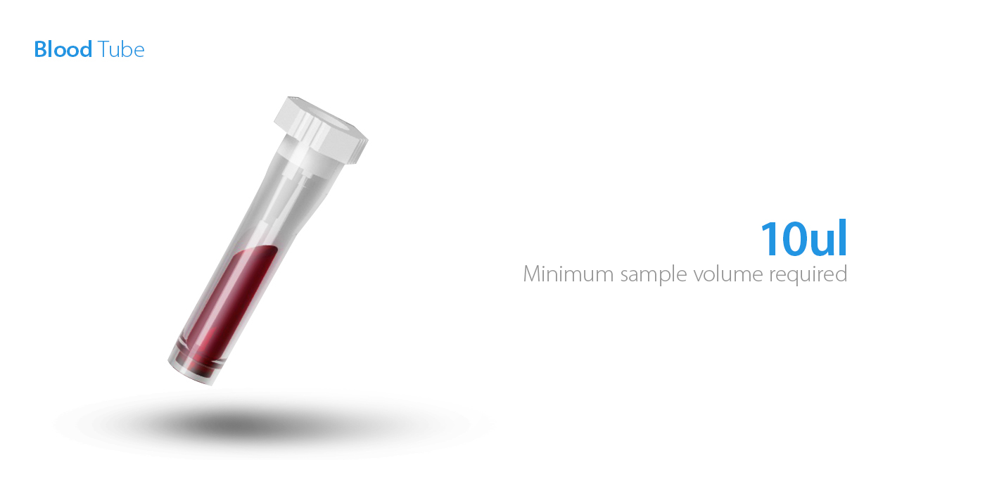 Aquila，Medical equipment，Blood analyzer，product design，