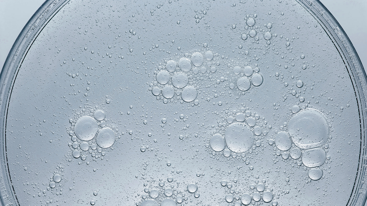 SOL，Medical costs，CMOS image，SK，disease infection，