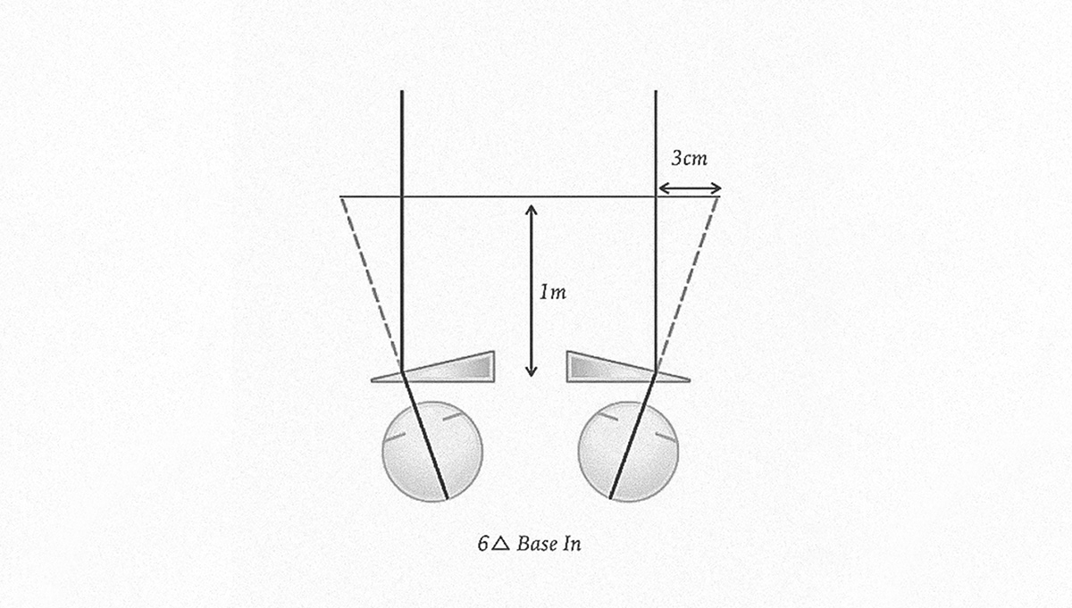 product design，Therapeutic apparatus，swp，wearable devices ，Design，design，3d，