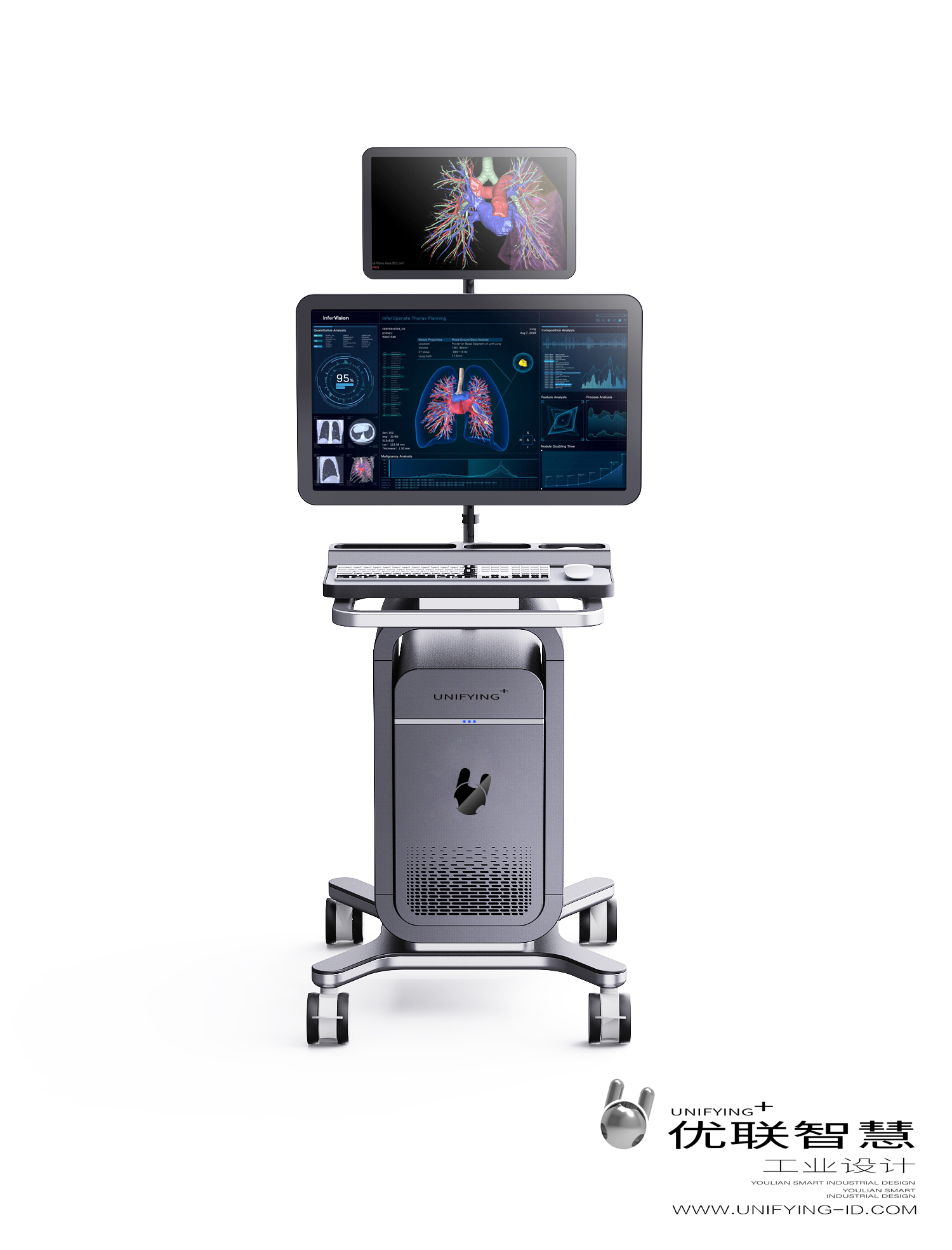 Chengdu Industrial Design，Chengdu Medical Design，Medical trolley，3D system，www.unifying-id.com，