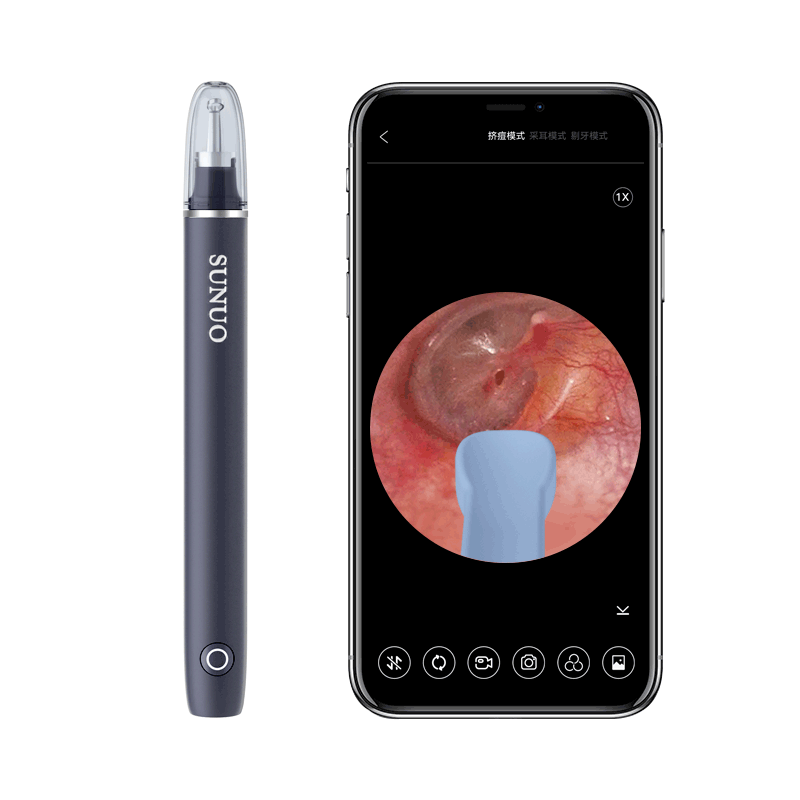 acne cleaning tool，Visual ear scoop，Minimalist，Light luxury，Multifunctional ear scoop and acne cleaning kit，Endoscope，