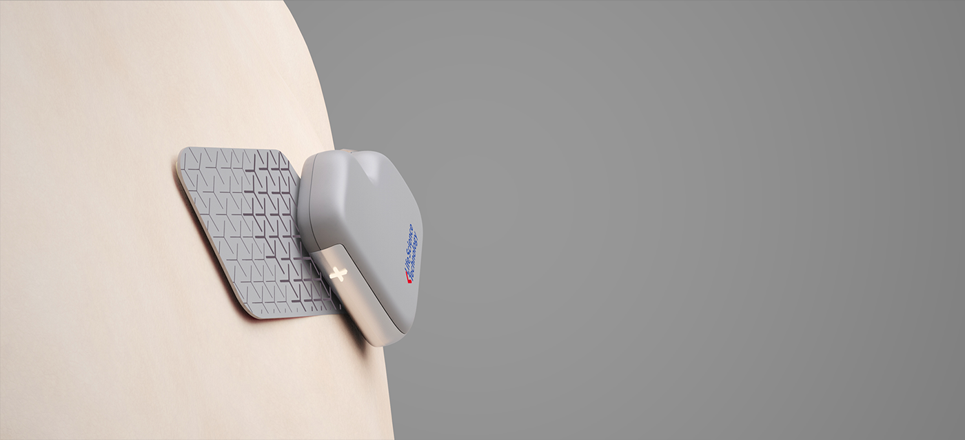 Temperature sensor，ECG，IMU，Positive and negative electrode stress analysis algorithm，