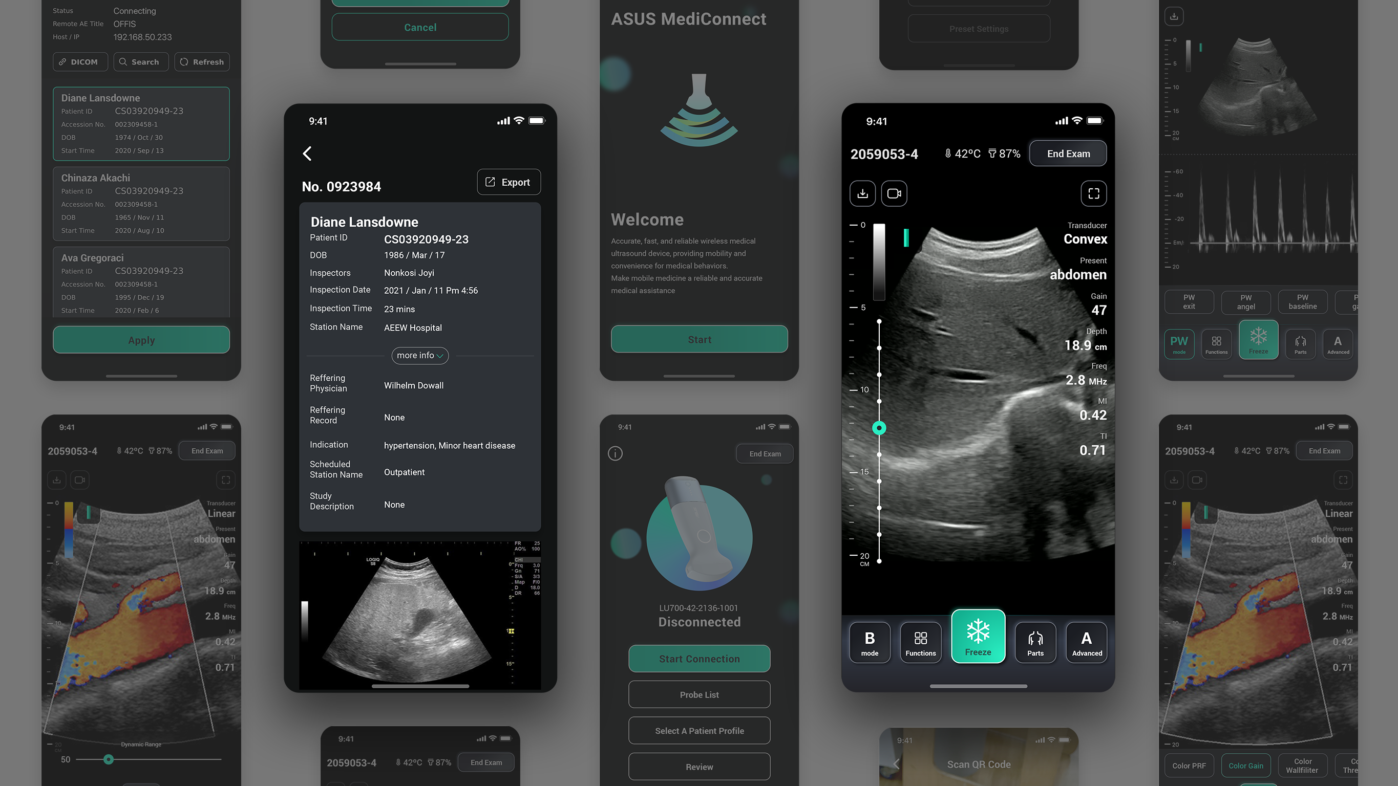 User interface (UI)，Product interface，