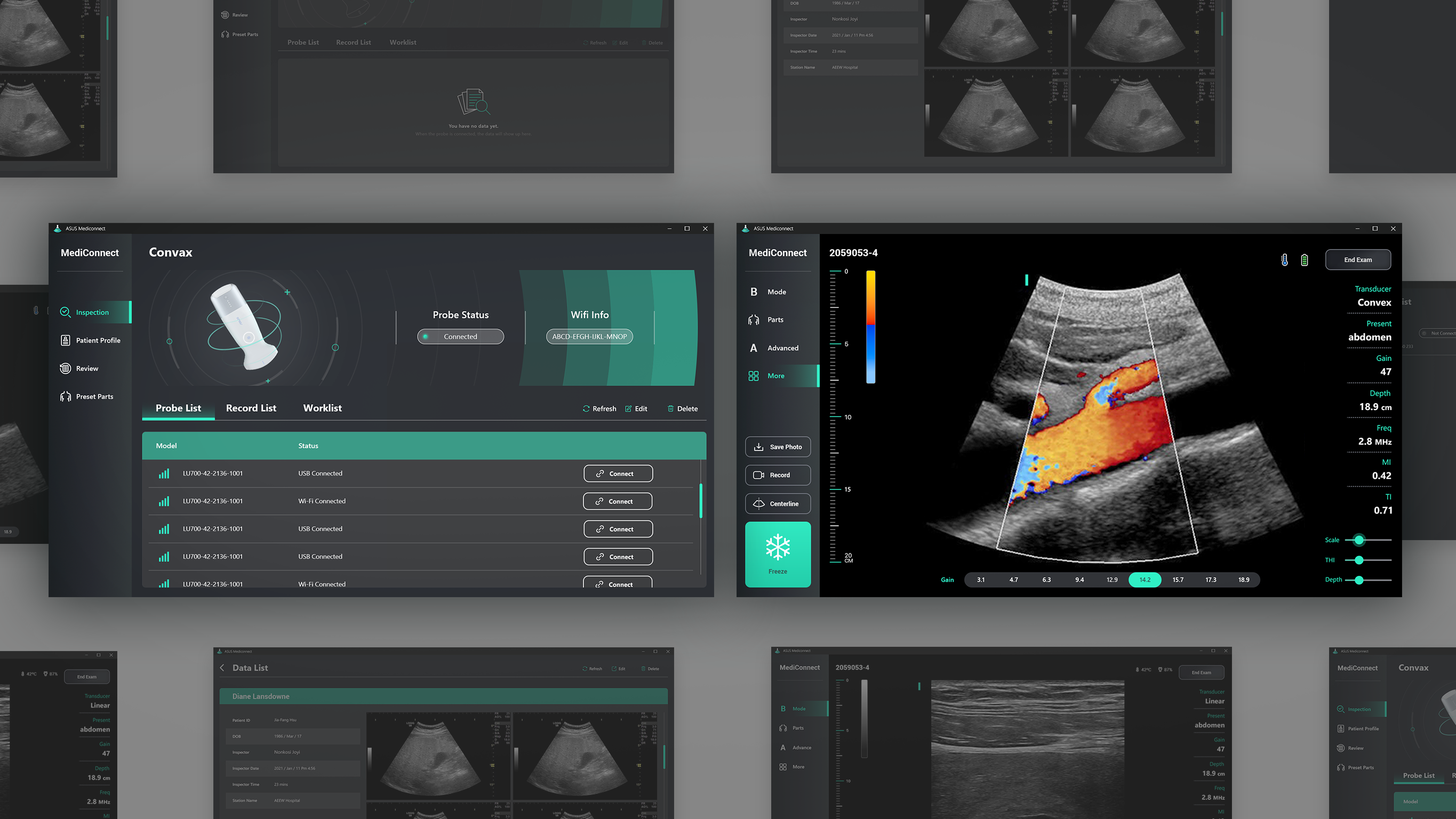 User interface (UI)，Product interface，