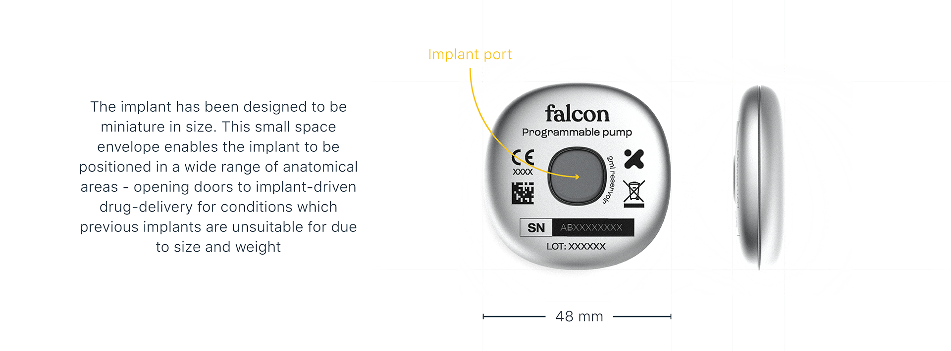 Parkinson，injection，Implantation，
