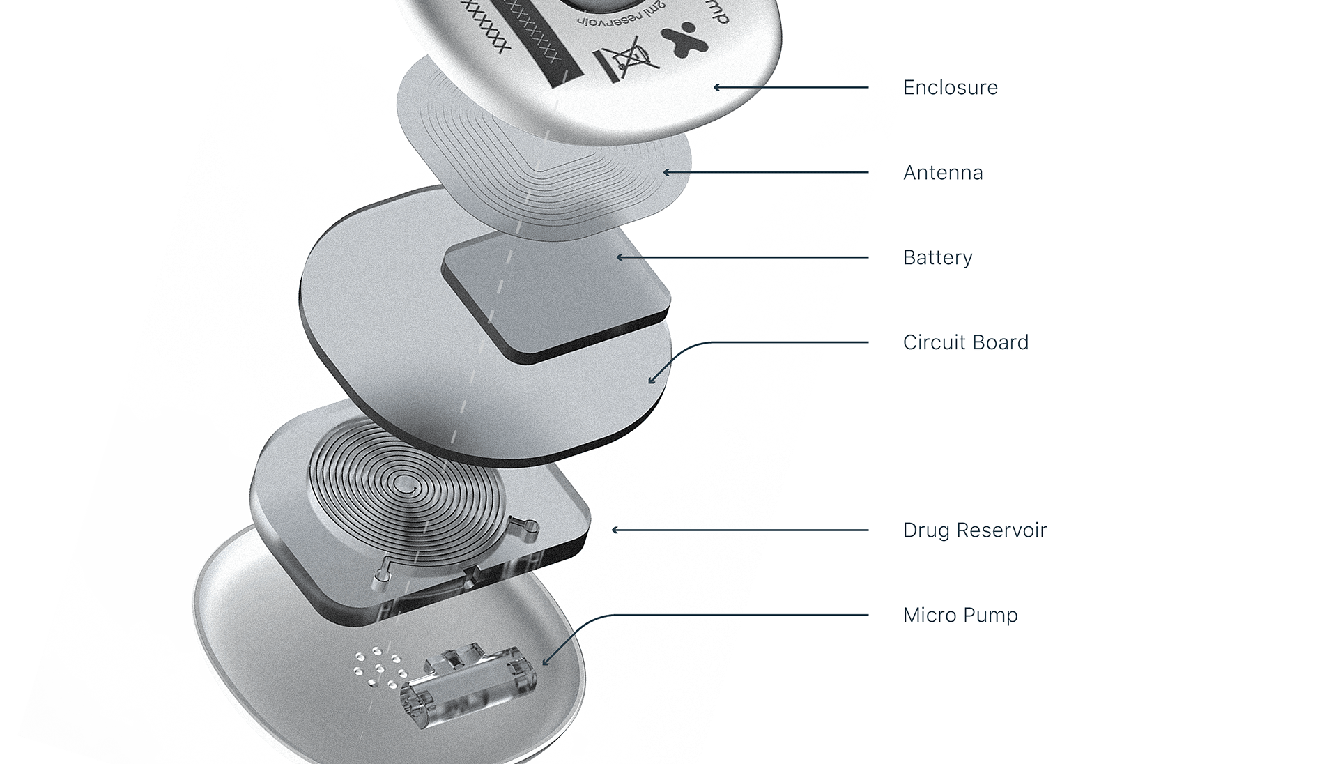 Parkinson，injection，Implantation，