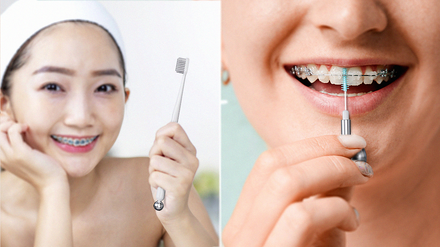 Human nature orthodontics, let your teeth "ineffective"，