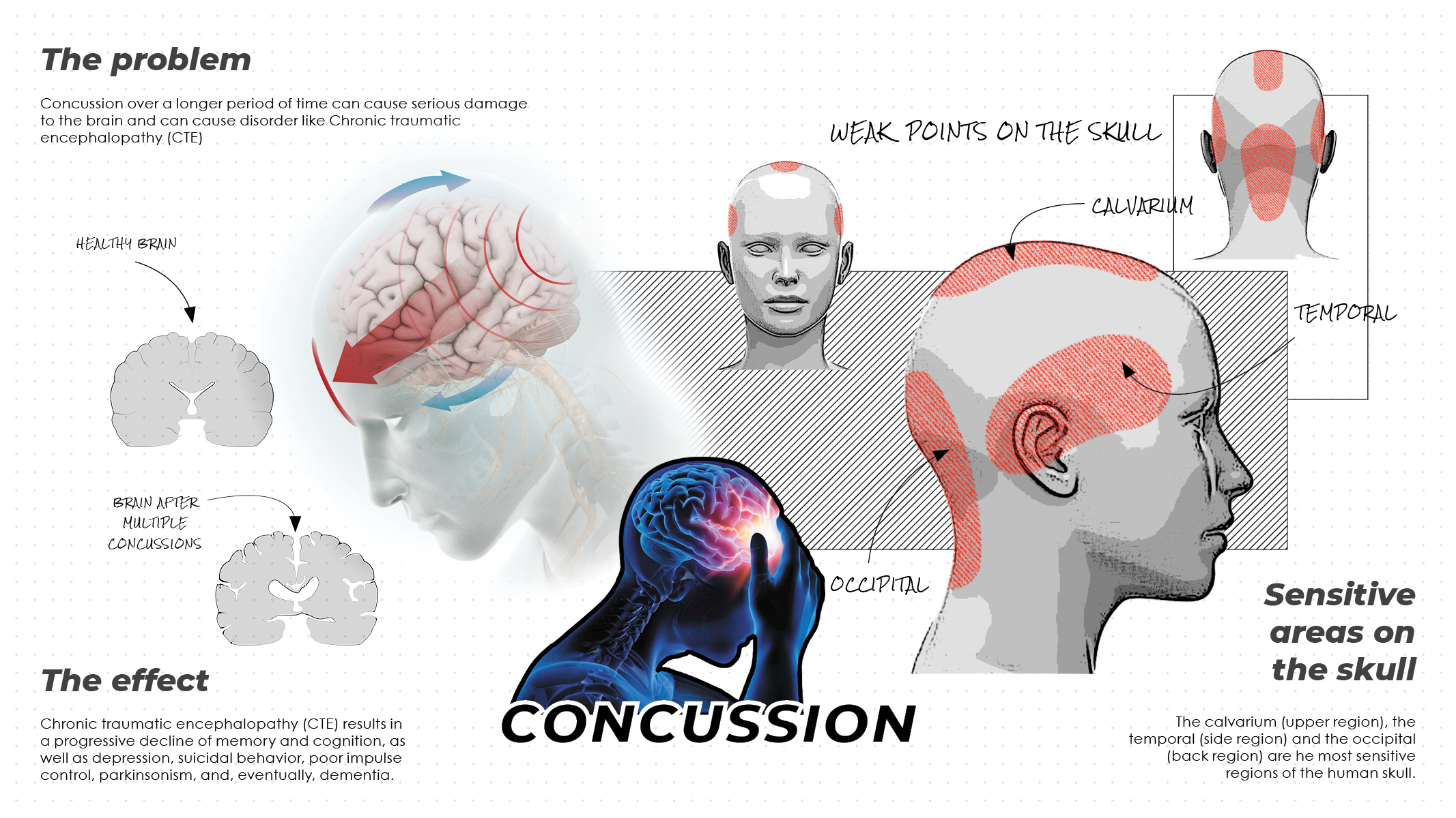 PA-RCAS，Bicycle helmet，Mountain bike helmet，Reduced concussion，