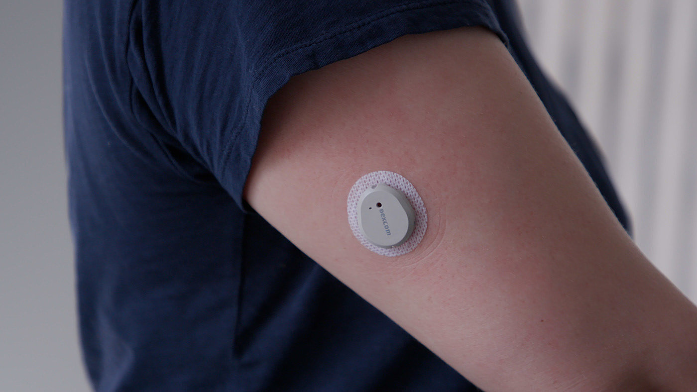 Non-invasive Glucome，Blood glucose meter，