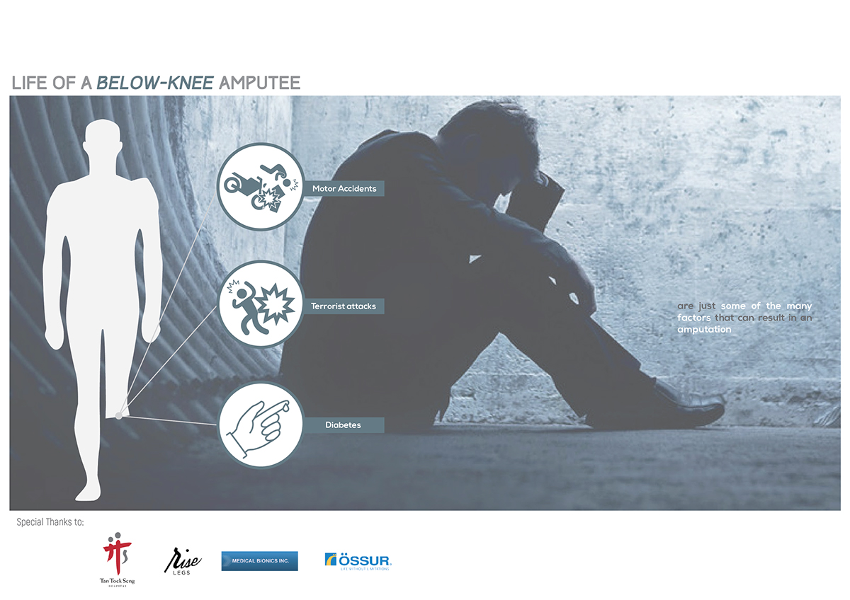 Prosthesis，Adjustable，if，a lower leg，