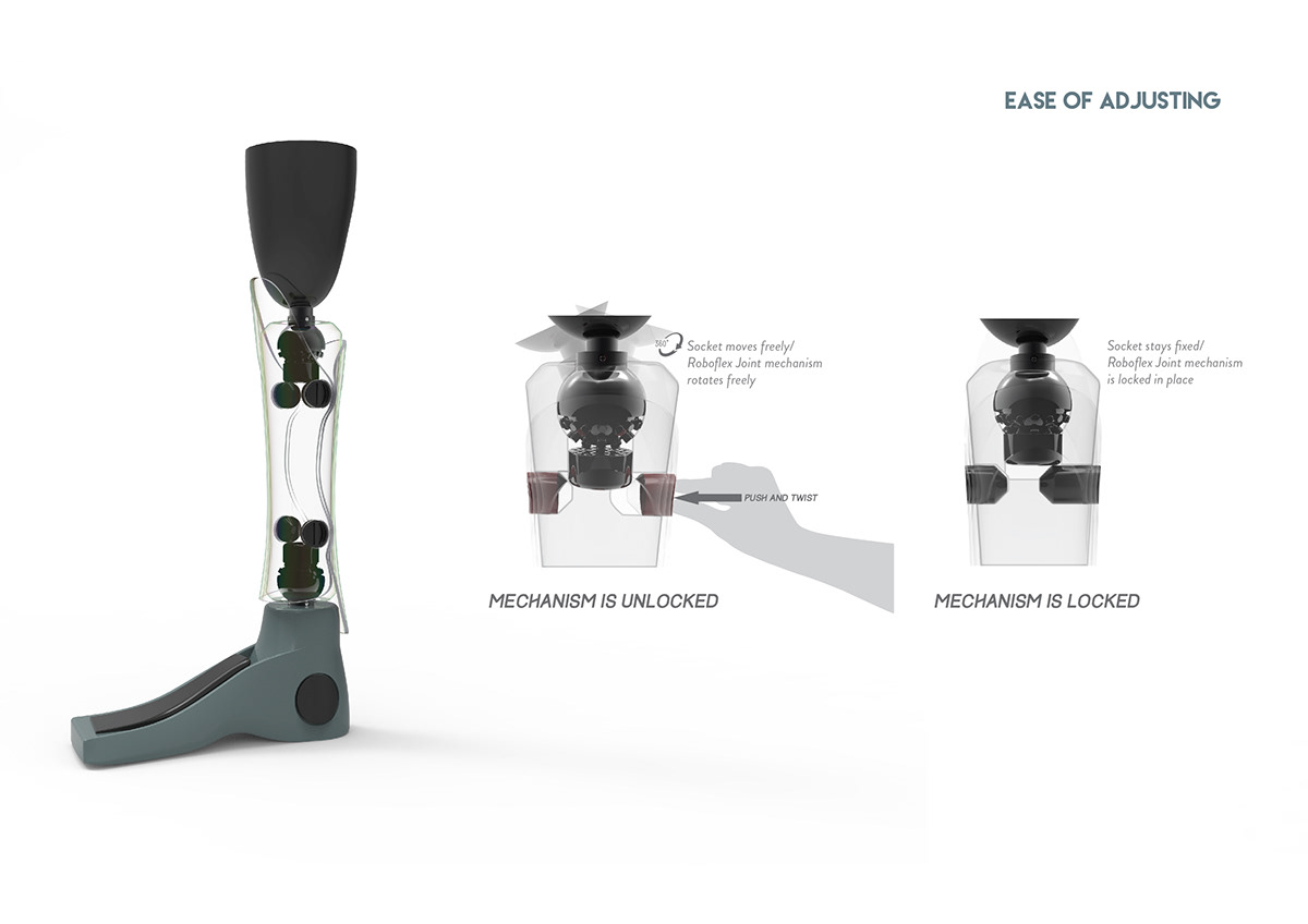 Prosthesis，Adjustable，if，a lower leg，