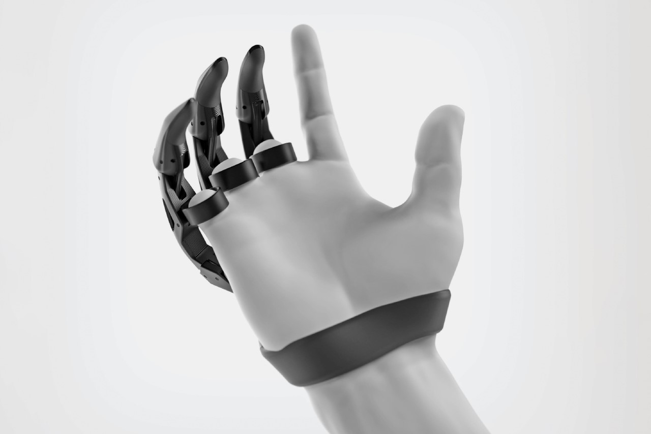 bionic prosthesis，3D printing，Lunet，medical apparatus and instruments，