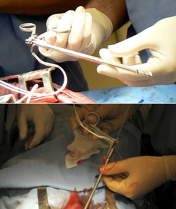 Scalpel，operation，Corr77，2013IDEA，heart surgery，