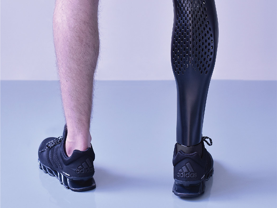 3D printing，Motor prosthesis，Prosthesis，human organ ，Legs，