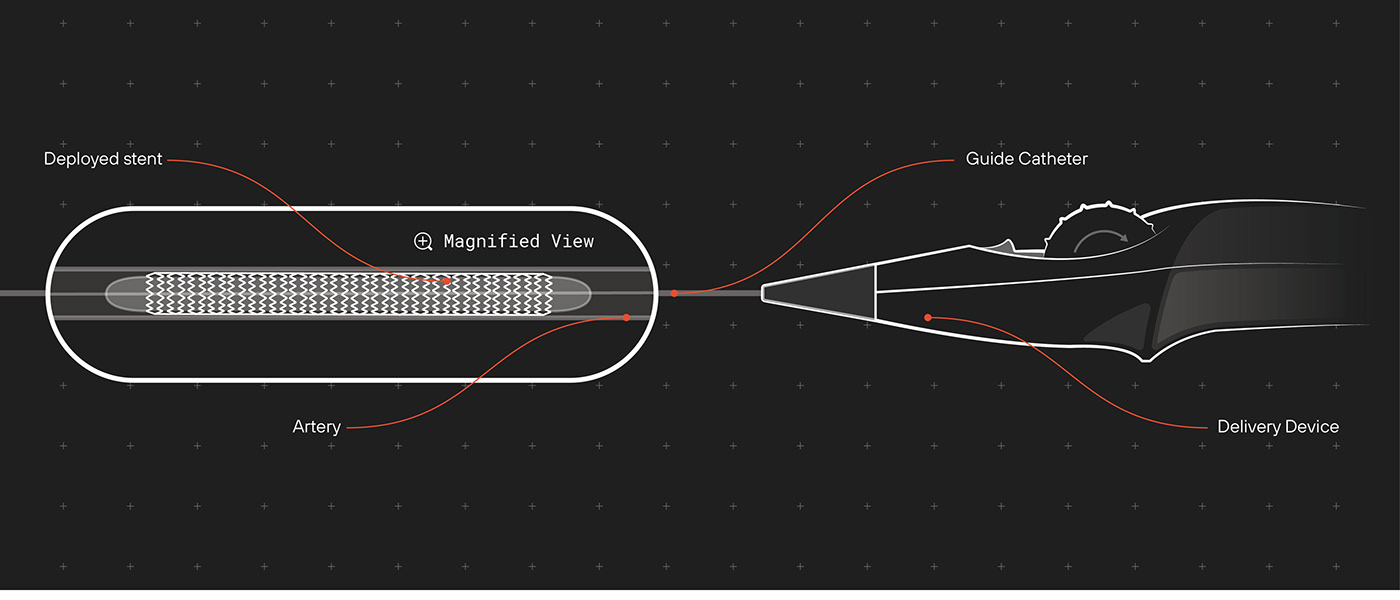 equipment，operation，One hand operation，convenient，