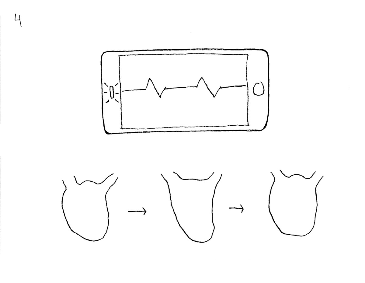 whisper，endocarditis，pulse，Heart rate change，Electronic stethoscope，Preventive health care，
