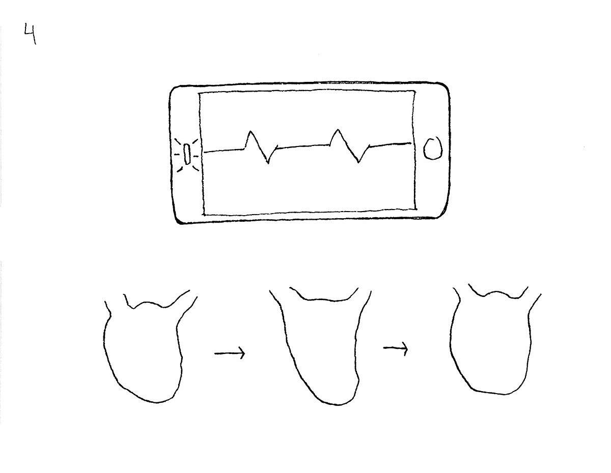 whisper，endocarditis，pulse，Heart rate change，Electronic stethoscope，Preventive health care，