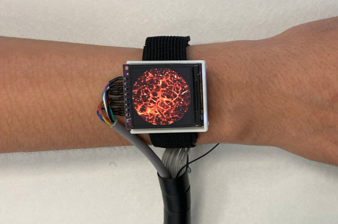 Digital，Intelligent Watch，wearable devices ，Medical equipment，