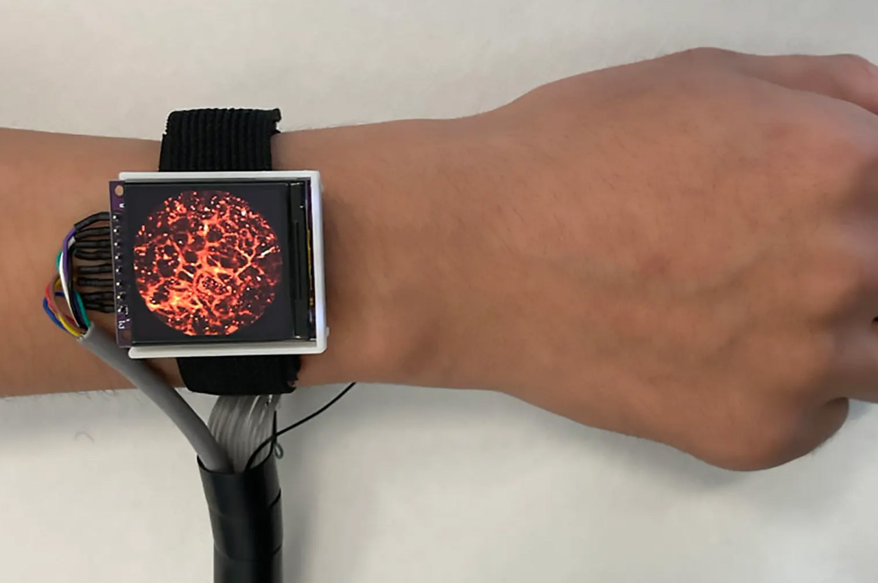 Digital，Intelligent Watch，wearable devices ，Medical equipment，