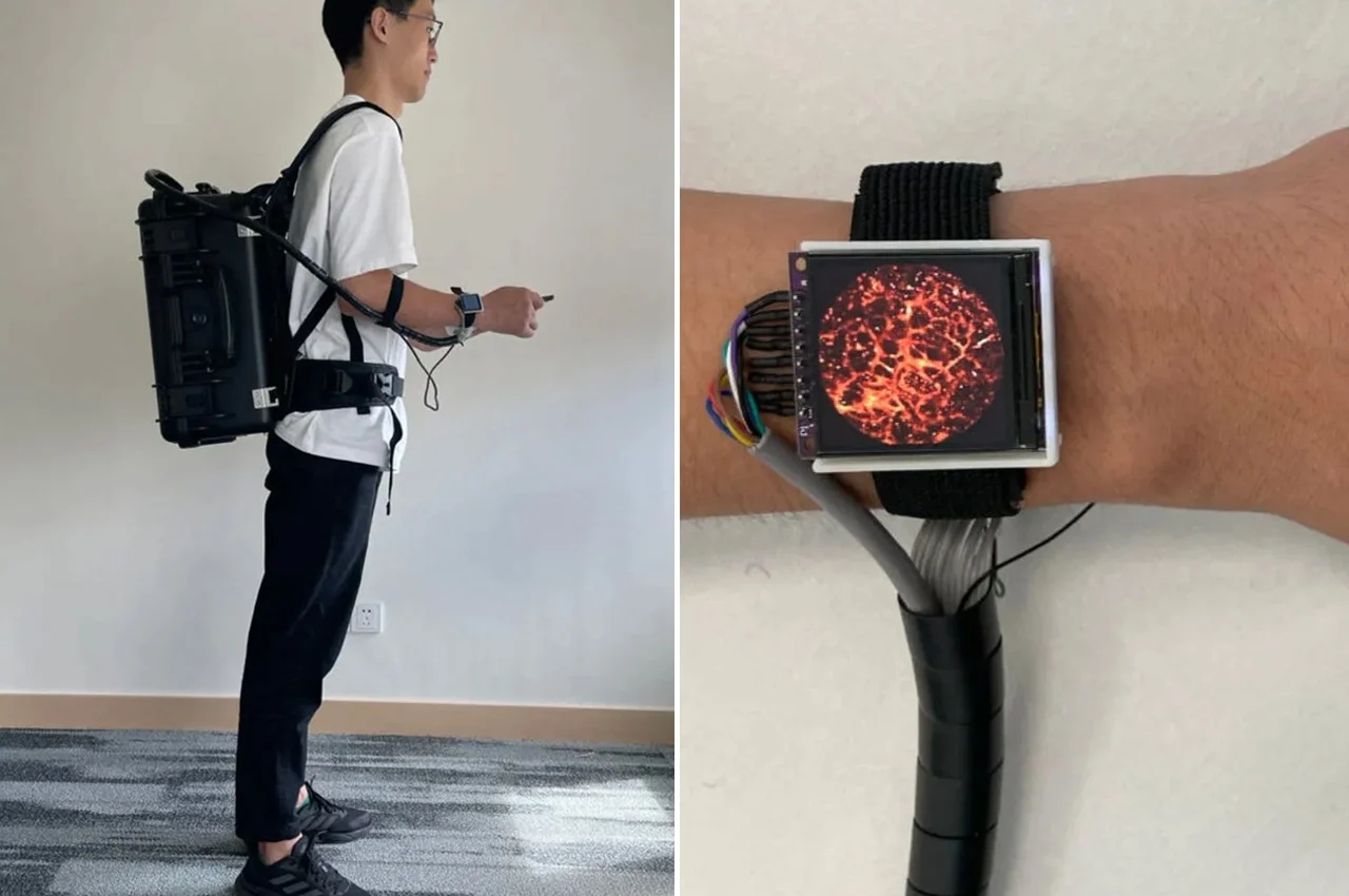 Digital，Intelligent Watch，wearable devices ，Medical equipment，