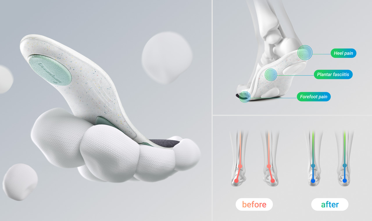 Insole，modularization，product design，