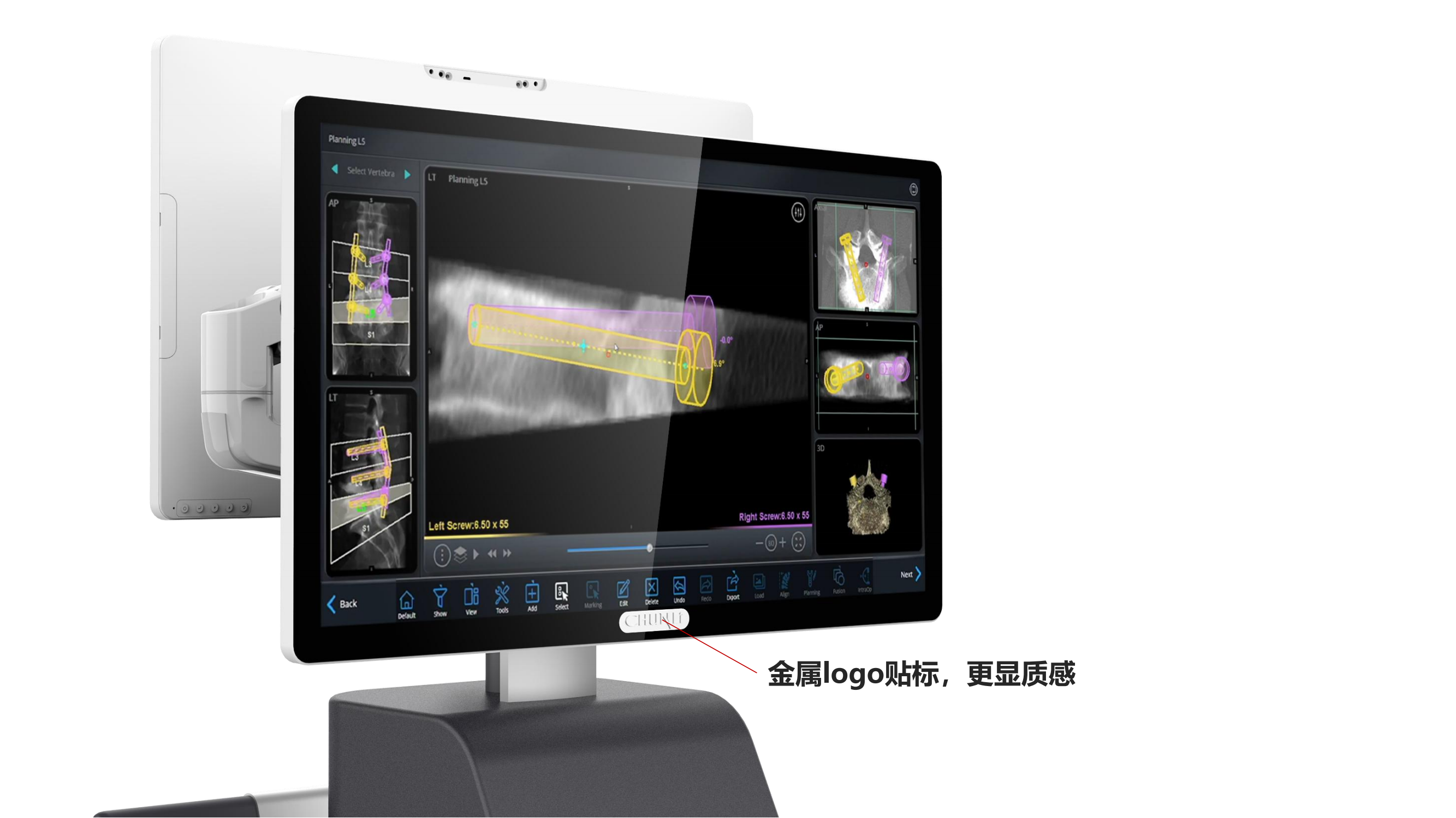 Surgical robot，Navigation system，