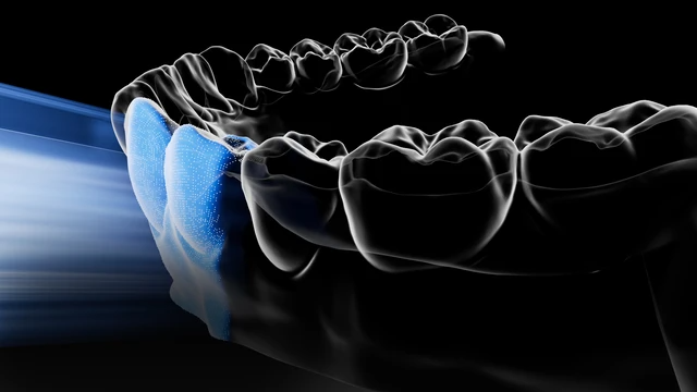 scanning，3d，oral cavity，