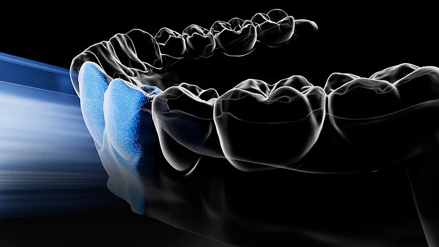 scanning，3d，oral cavity，