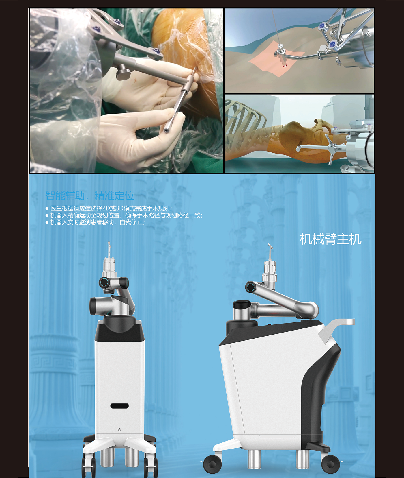 organic arc shape，Detail processing，Sense of science and technology，Idea Award，Orthopedic surgery，robot，