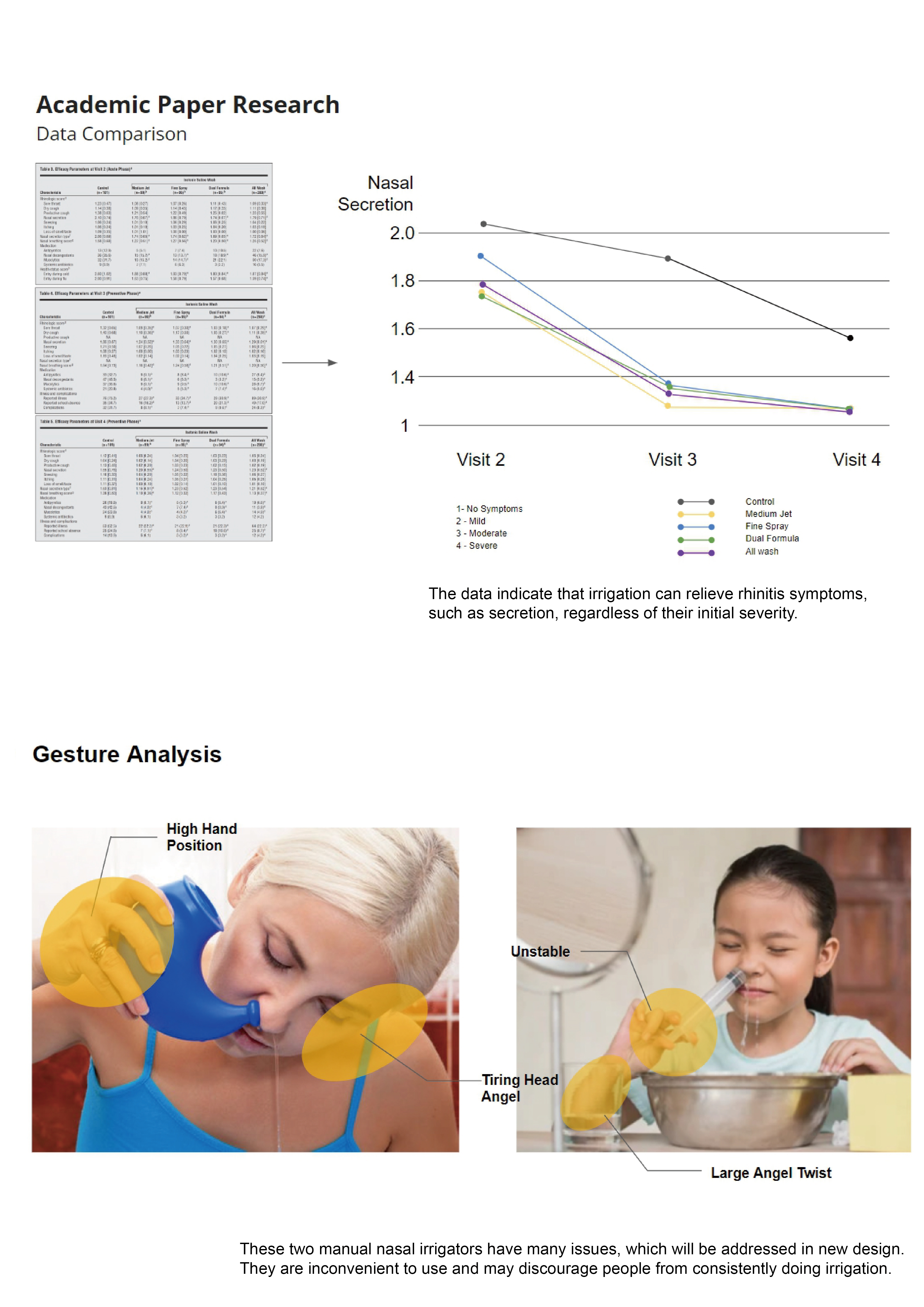 Nasal Washers, Rhinitis，