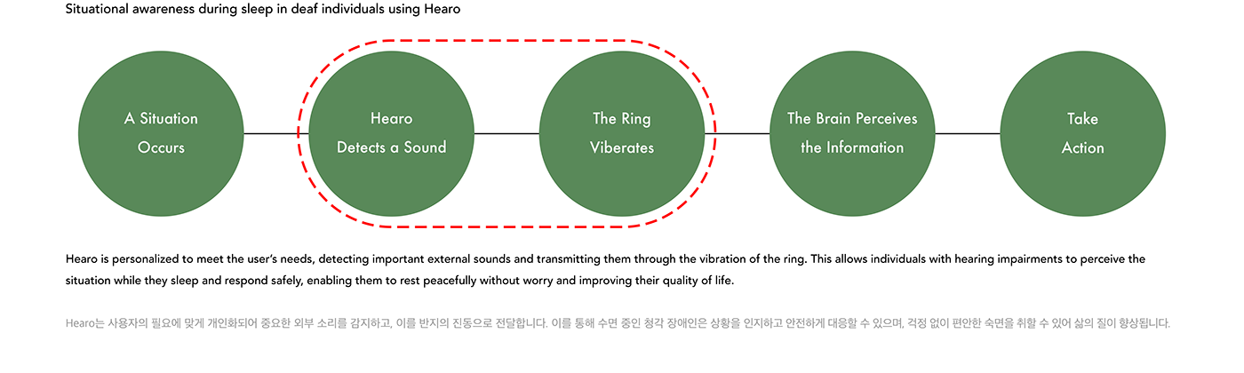 deaf-aid，Ring，O，Relieve Anxiety，