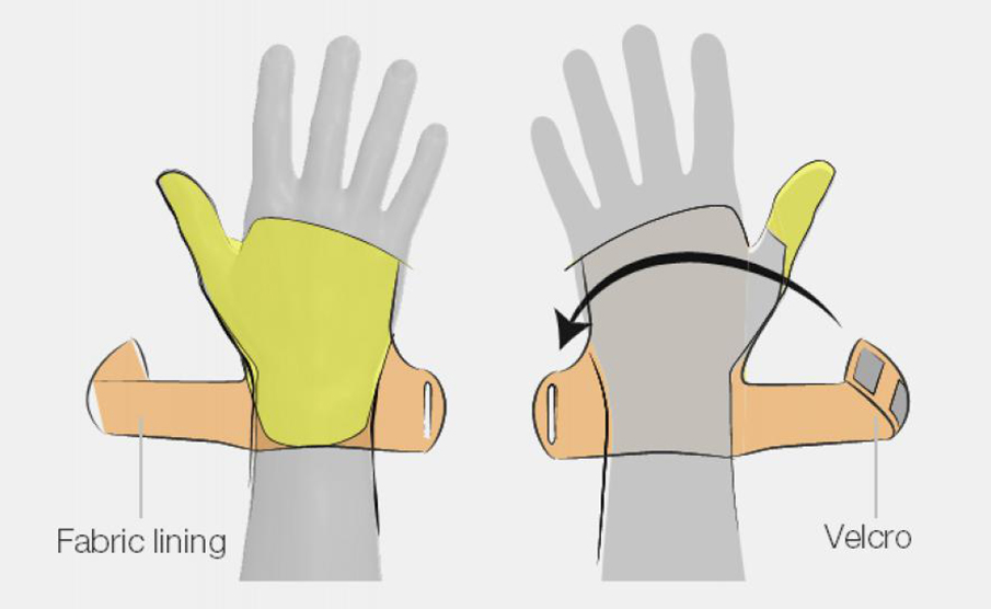 Medical product design，Industrial Design of Medical Products，Wearable product design，