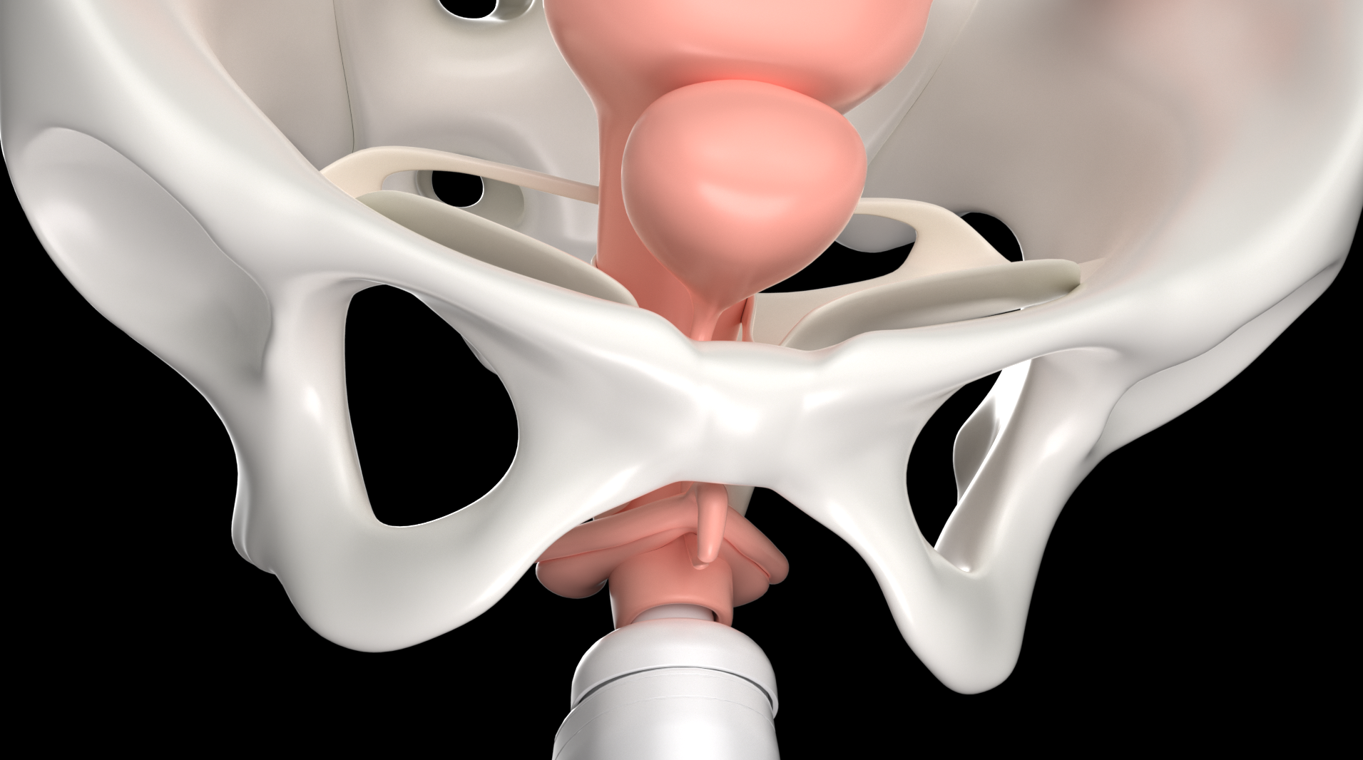 radio frequency，medical apparatus and instruments，Medical Animation，