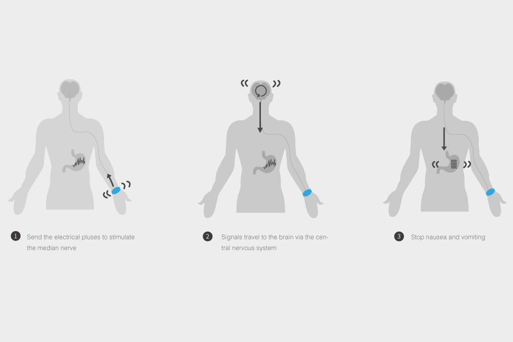 Anti carsickness，Bracelet，product design，