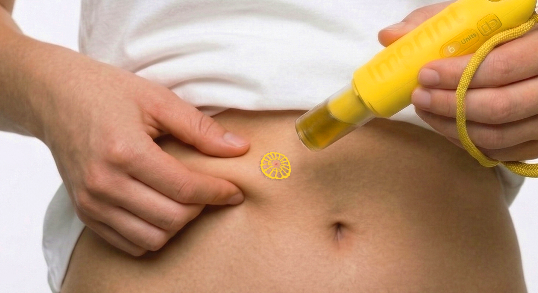 Syringe，product design，conceptual design，Caring design，