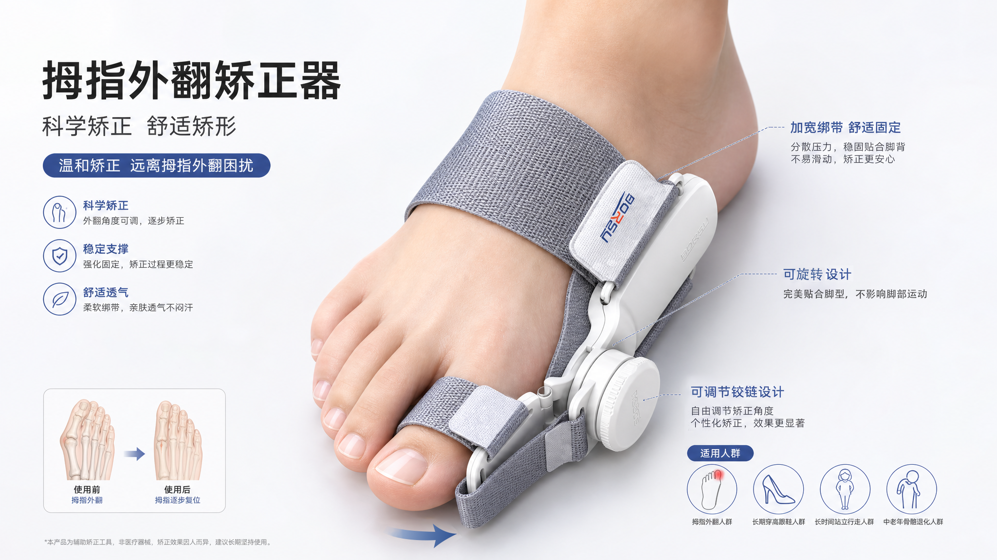 toe thumb hallux valgus，Thumb correction，Toes Thumb Hallux Valgus Thumb Hallux Big Toe，Health Care，medical care，