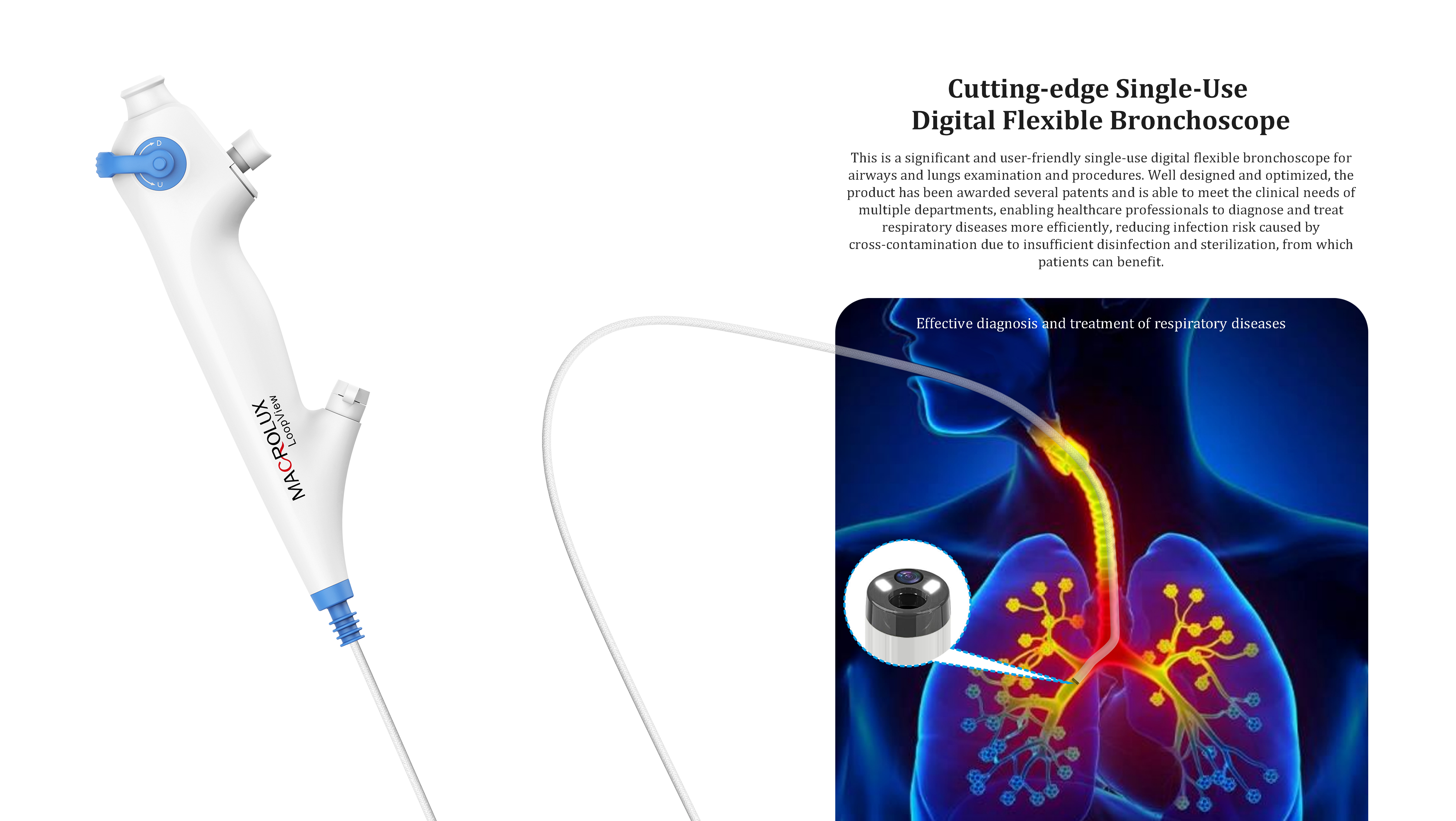 Endoscope，