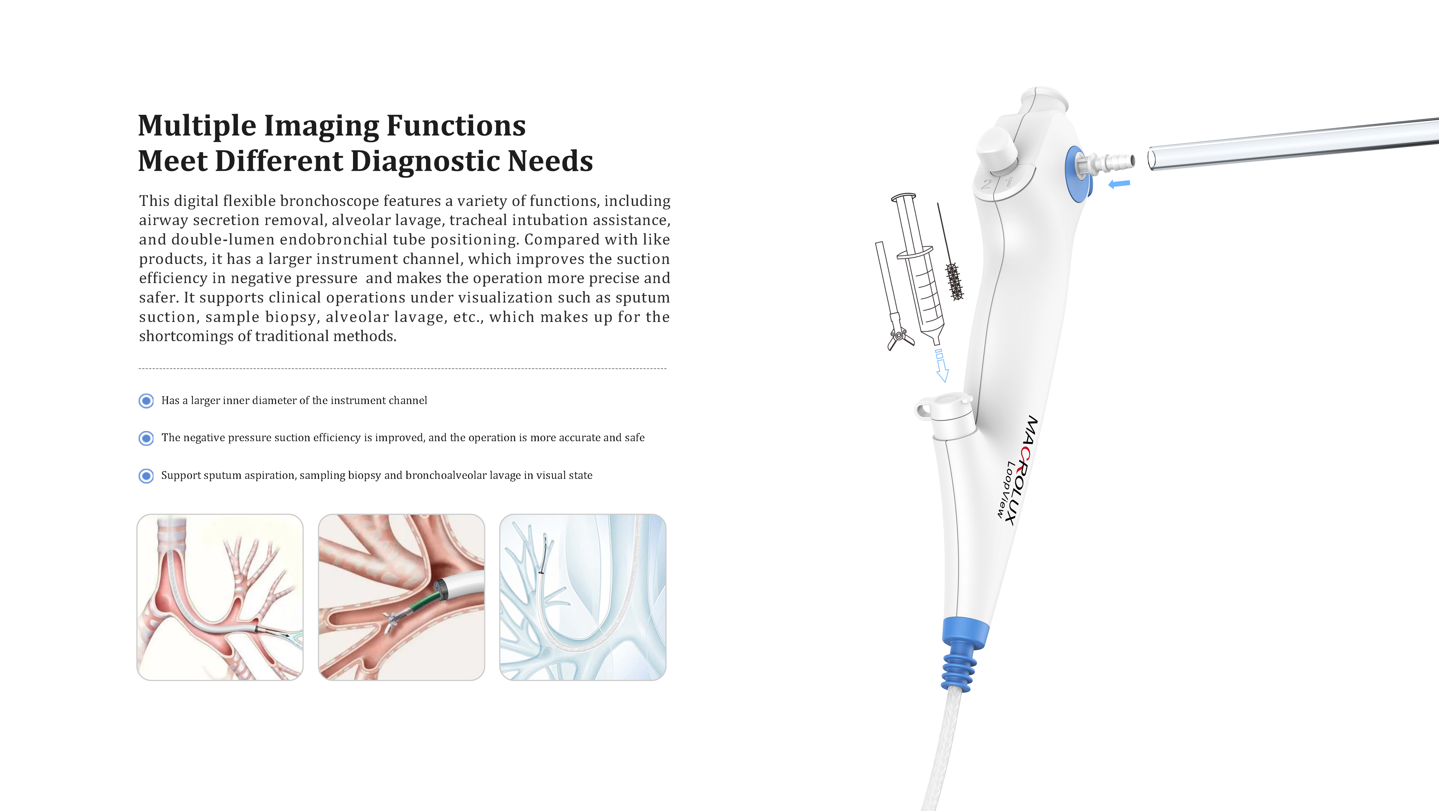 Endoscope，