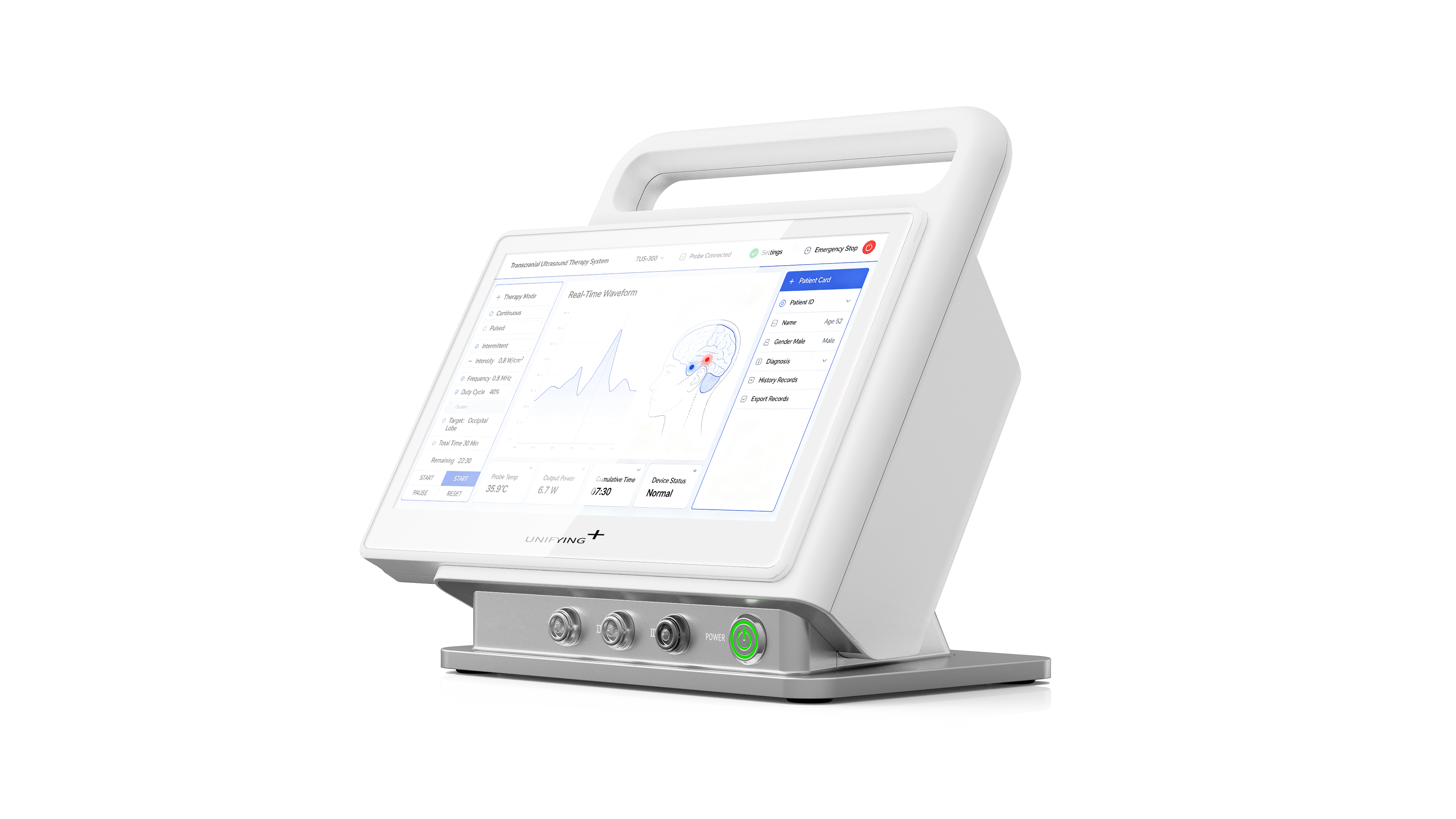Chengdu Industrial Design, Chengdu Medical Design, Ultrasonic Equipment Design，