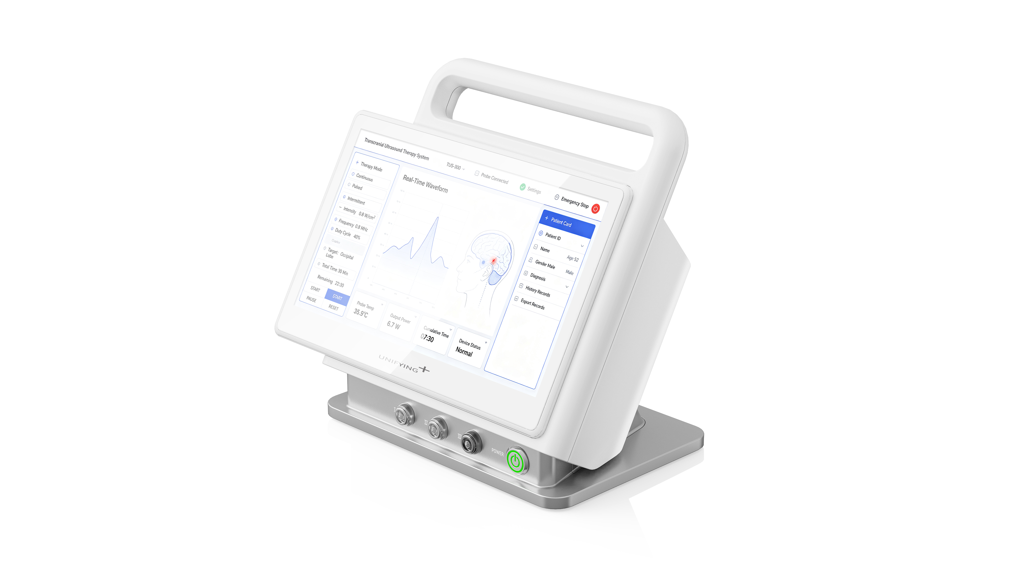 Chengdu Industrial Design, Chengdu Medical Design, Ultrasonic Equipment Design，