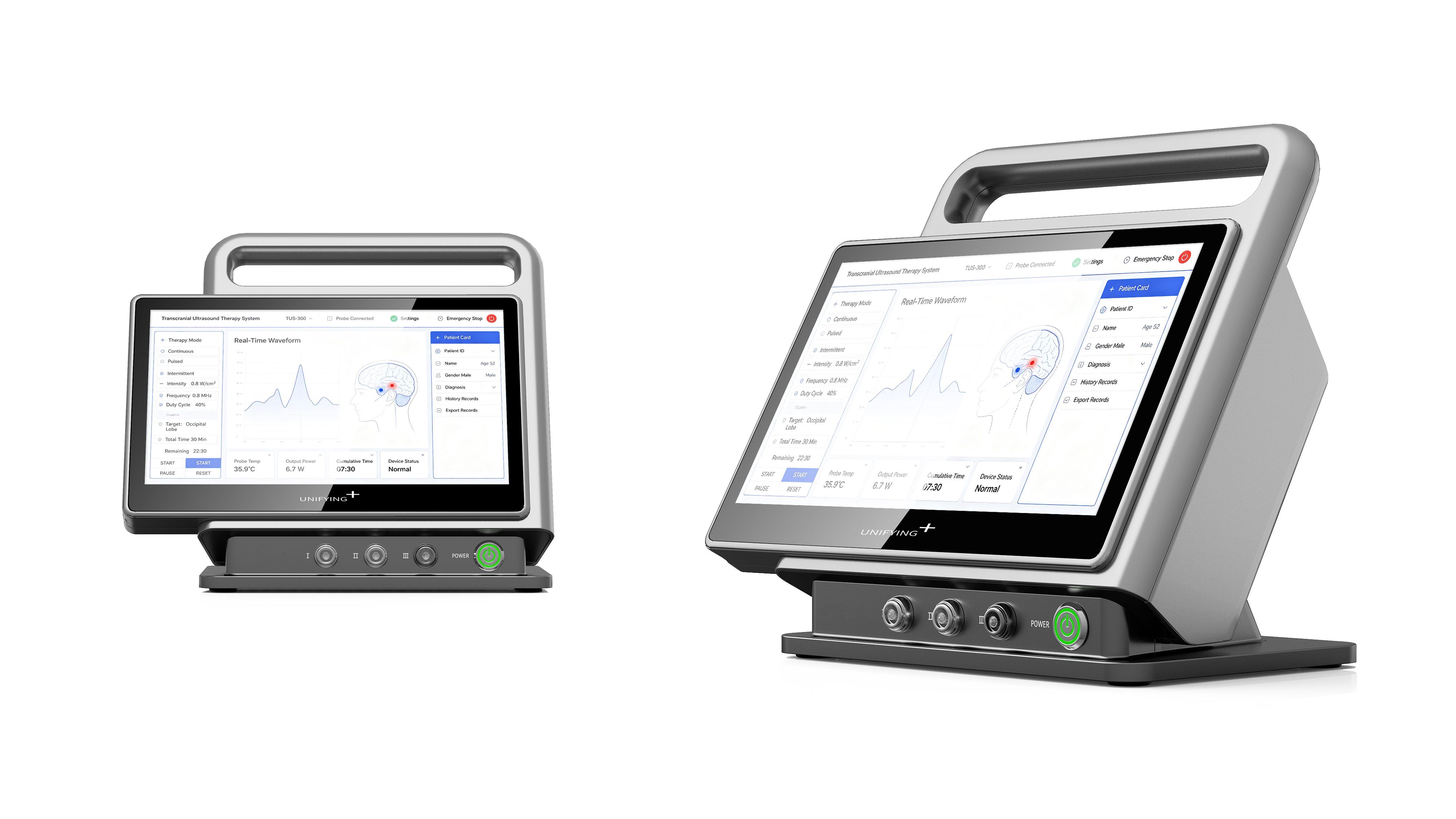 Chengdu Industrial Design, Chengdu Medical Design, Ultrasonic Equipment Design，